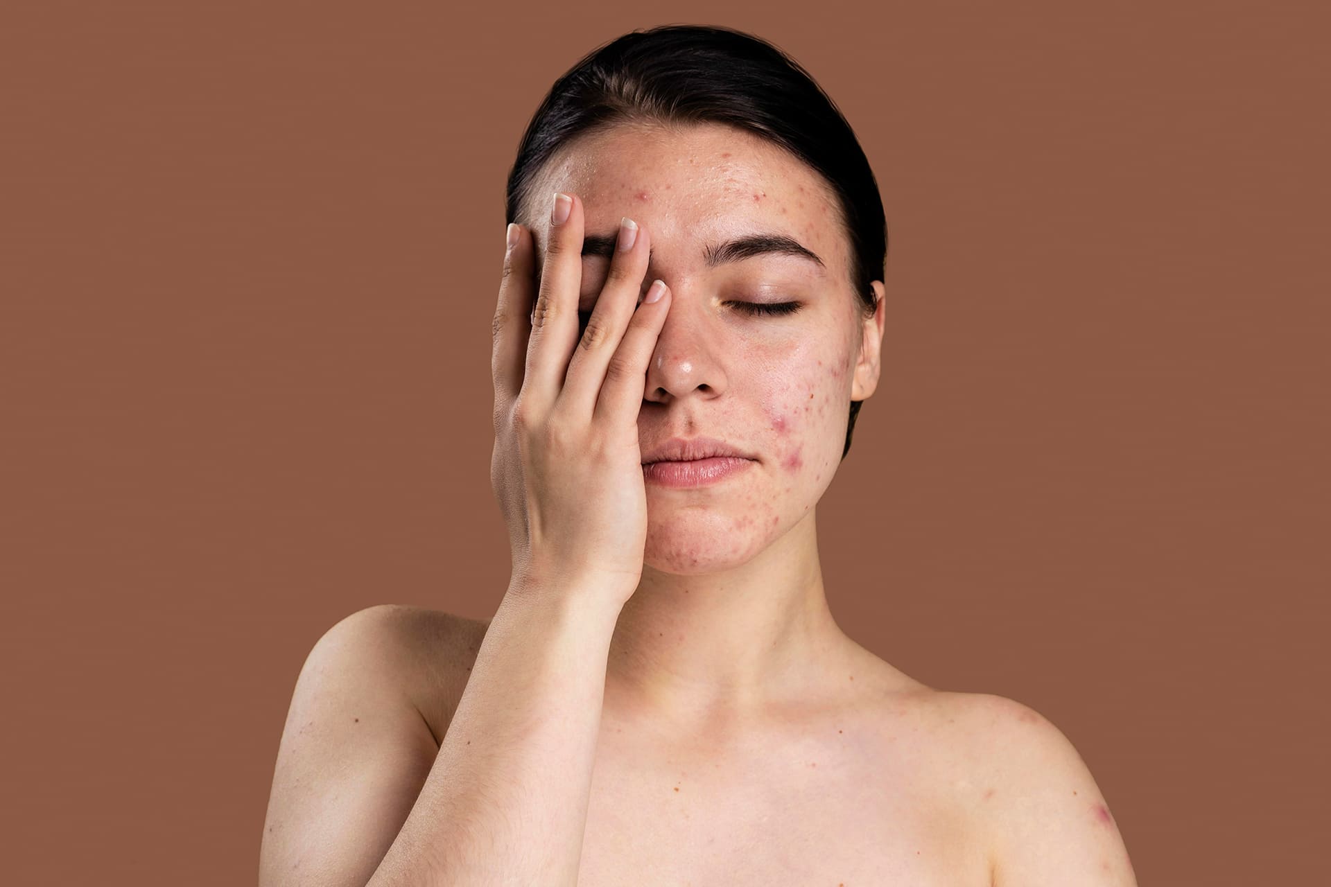 soteri skin blogs